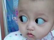 降调针打了可不可以跑步？可不可以跑步看完就有数了